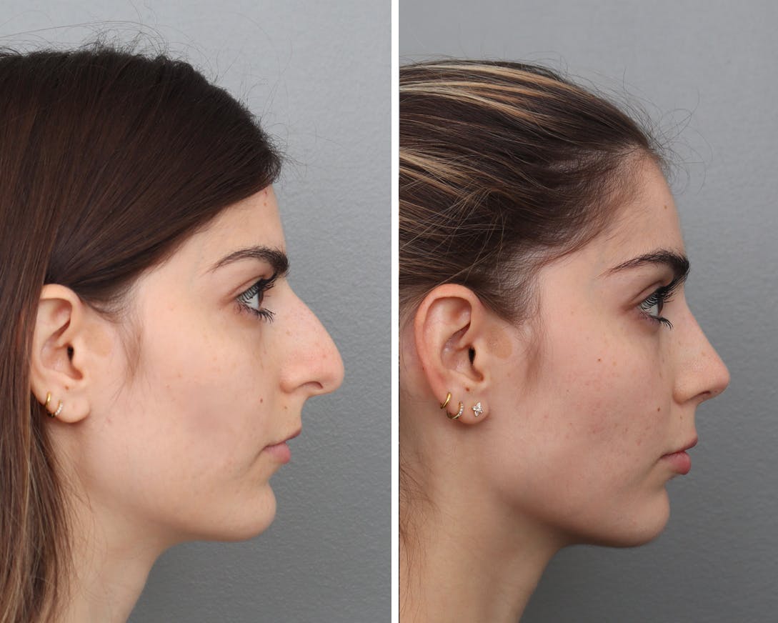 procedure