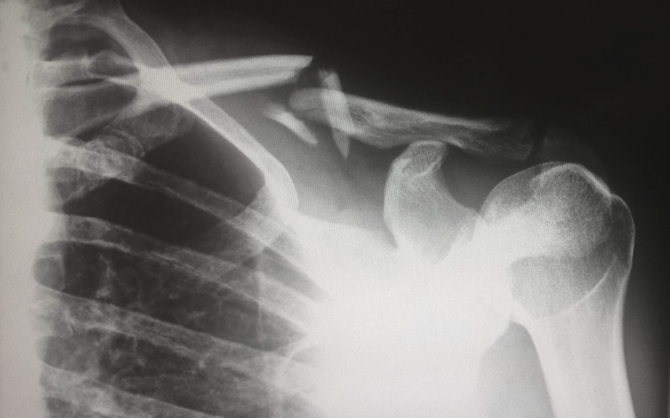 Musculoskeletal Disorders - Supporting Employees
