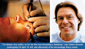 Man getting eye treatment