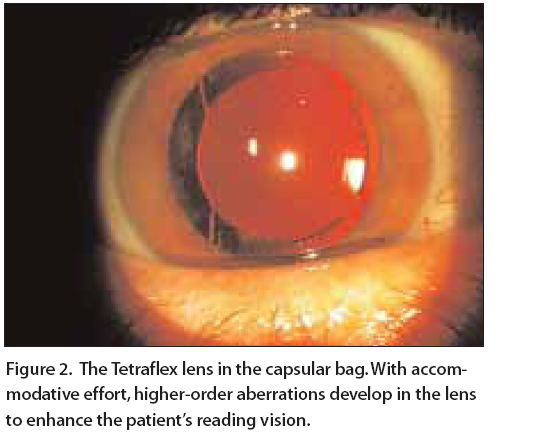 Eye diagram