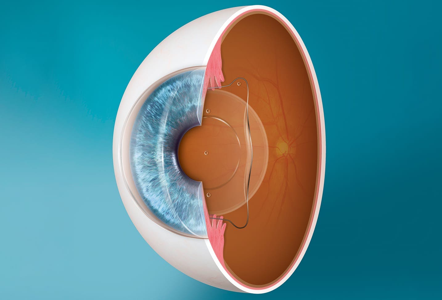 Eye diagram