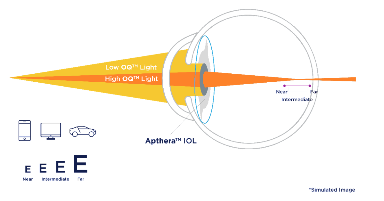 Eye diagram