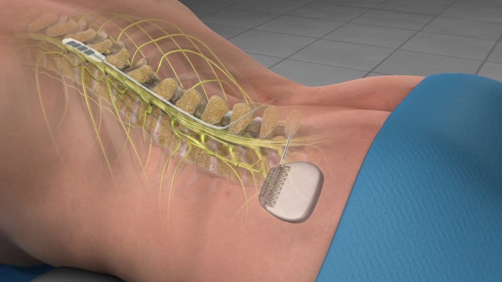 a close up of a person with a device on their back
