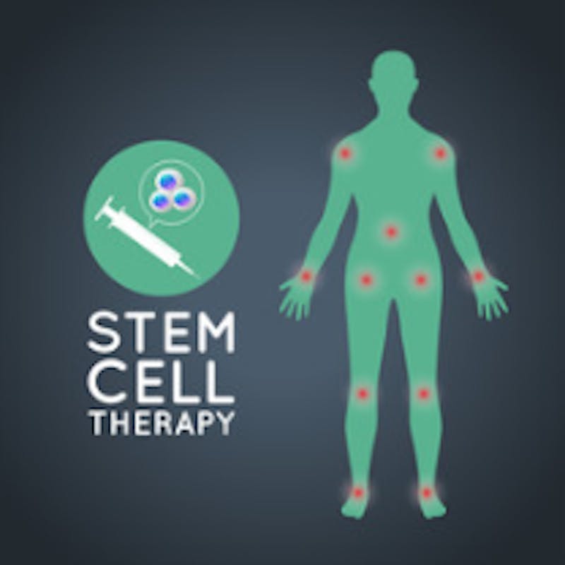 stem cell therapy graphic image