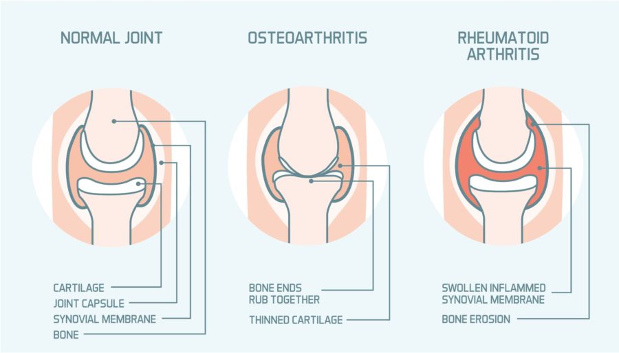 joint diagram image