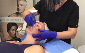 woman receiving SkinPen treatment