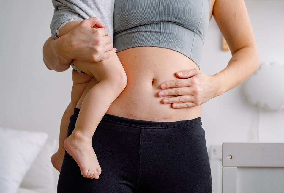 Woman holding child