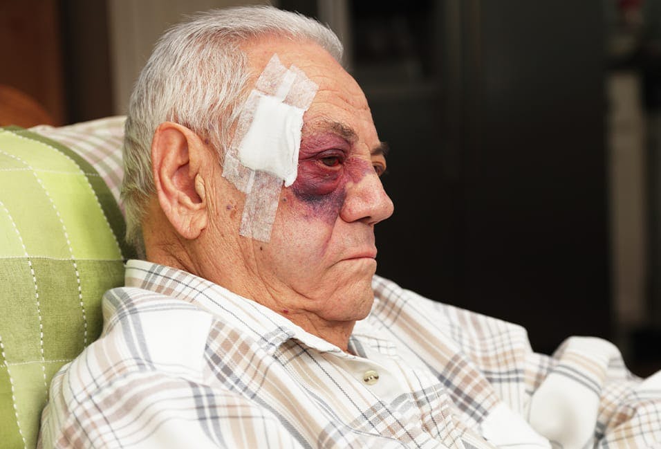 Man with severe eye injury