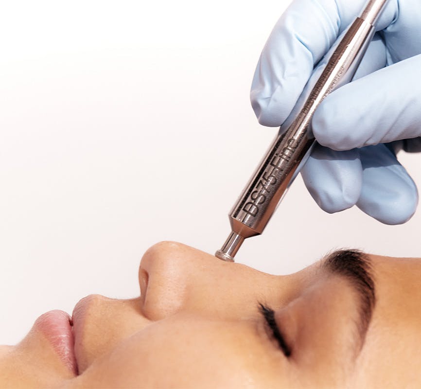 close up of someone applying DiamondTome system to a woman's nose