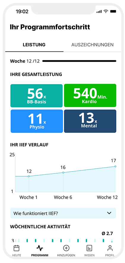 Fortschrittsverfolgung