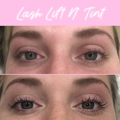 Lash Lift & Tint Before & After Gallery - Patient 133214035 - Image 1