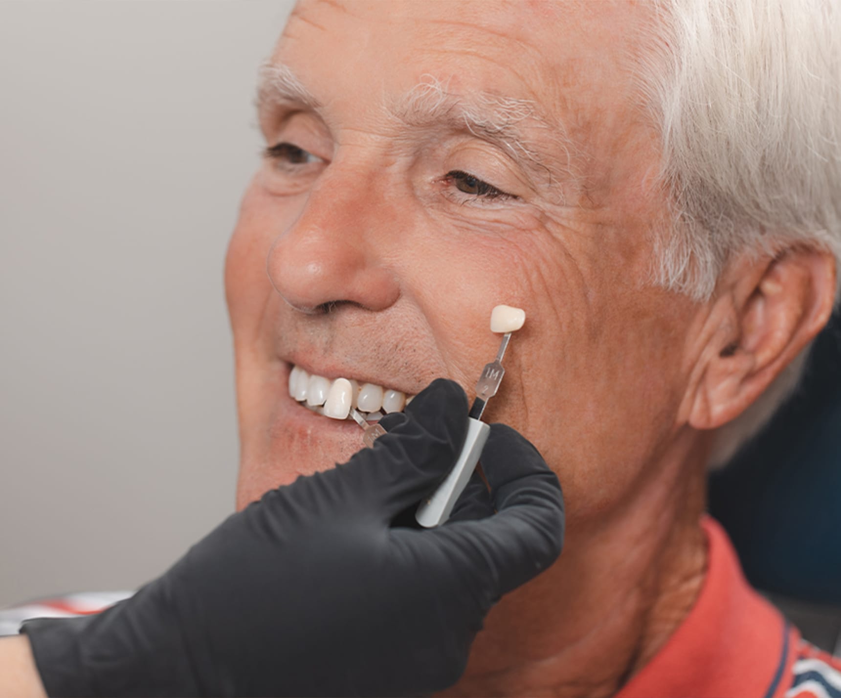 Cosmetic Dentistry Lisle Porcelain Veneers Naperville Ladone Family