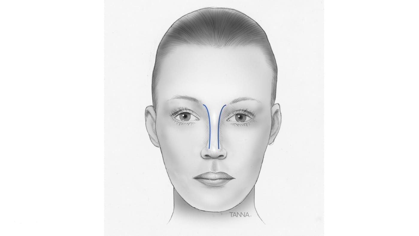 Drawing of a Woman's Face
