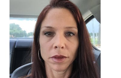 Botox Before & After Gallery - Patient 112338670 - Image 2