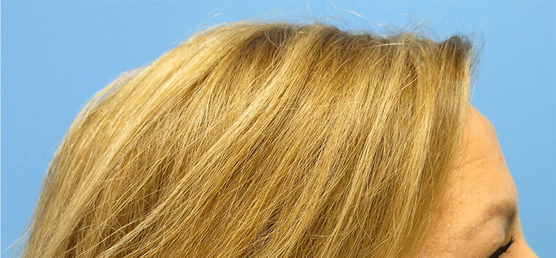Side Profile of the Top of a Head