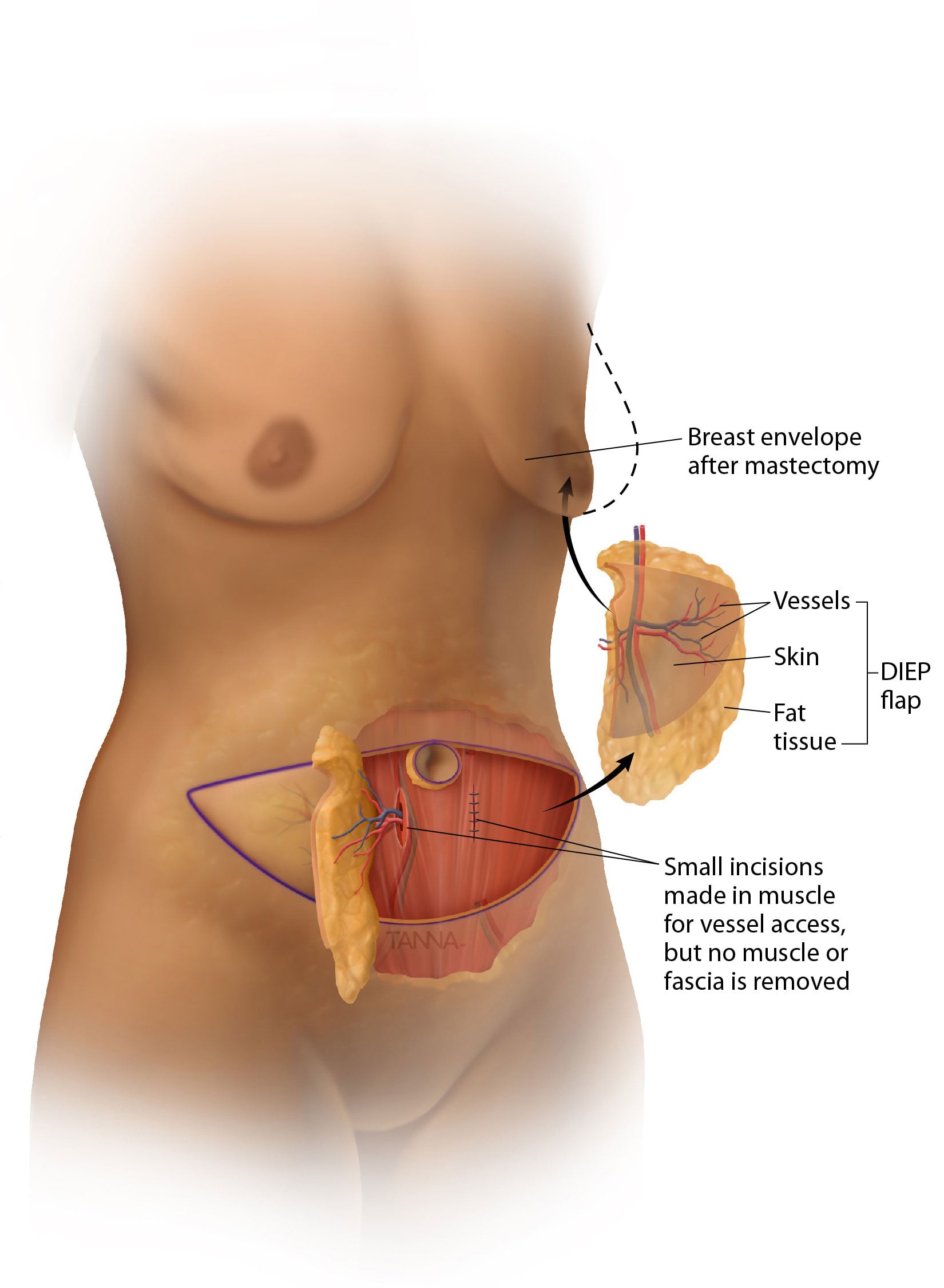 Infographic of a Woman's Body