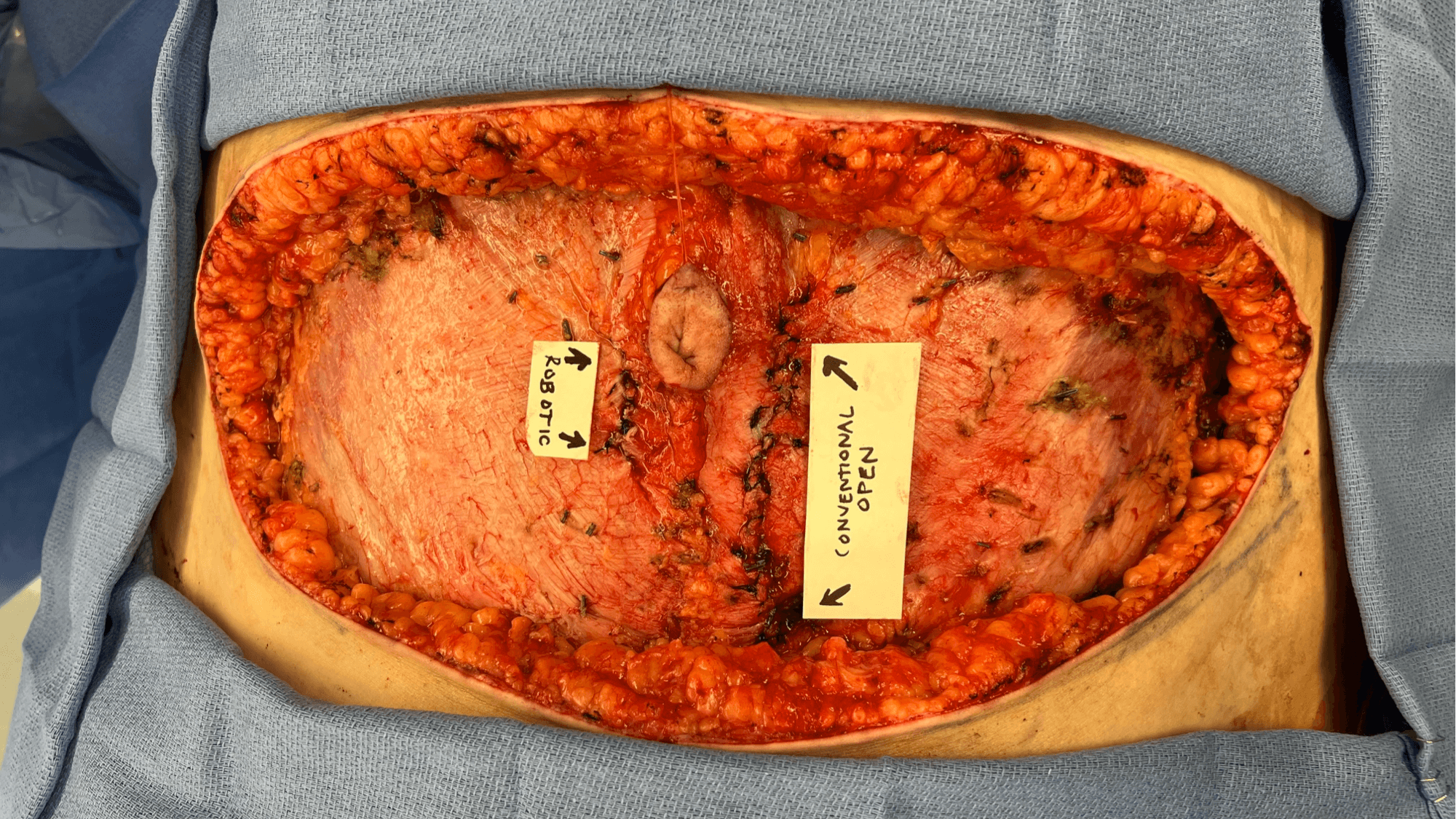 Inside of a Stomach