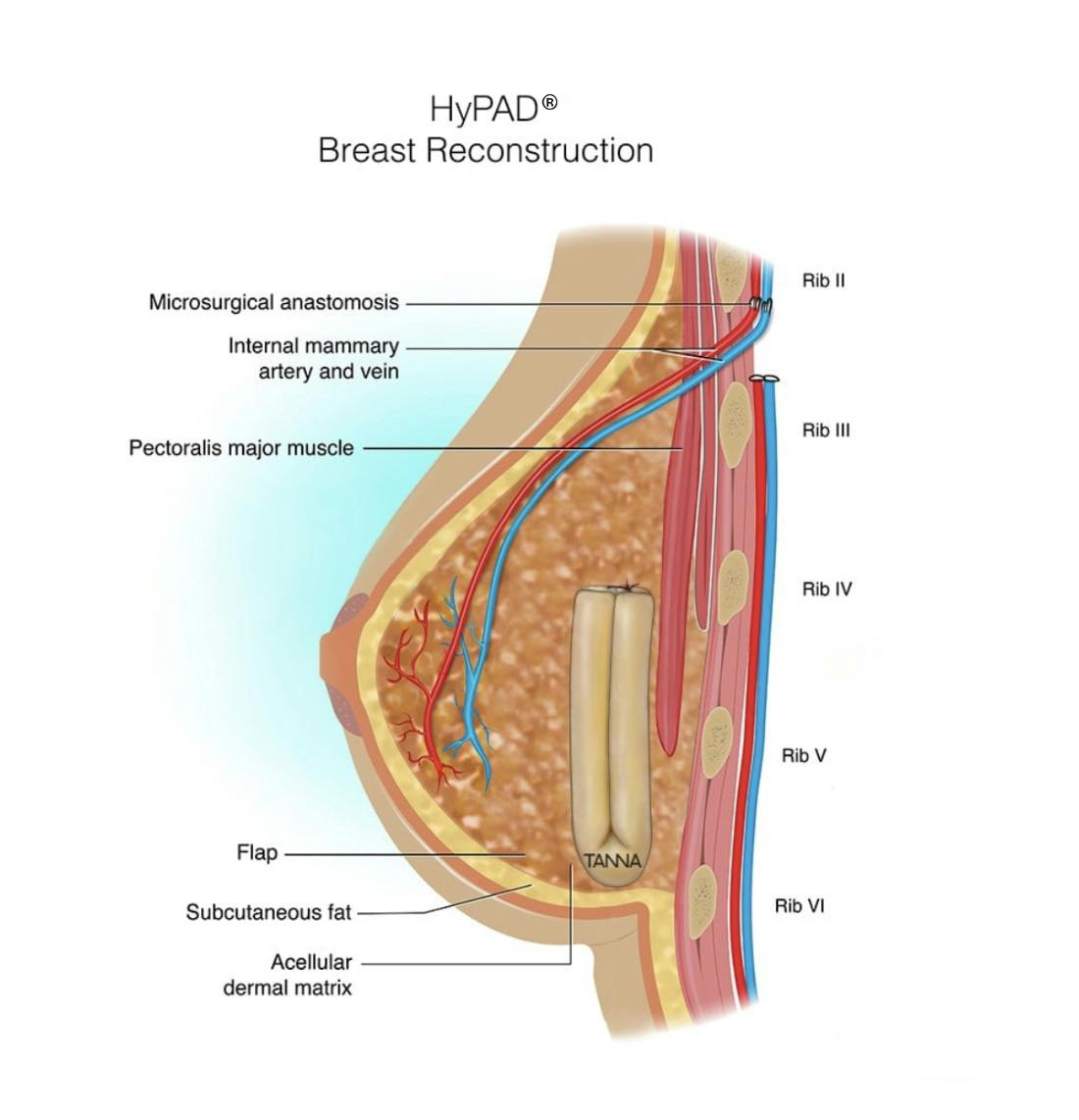 a diagram of a breast with the different parts labeled