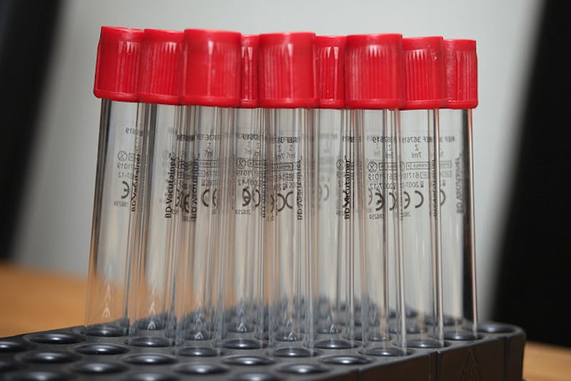 a close up of a bunch of tubes with red caps