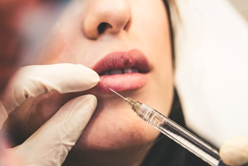 woman receiving lip injection from doctor