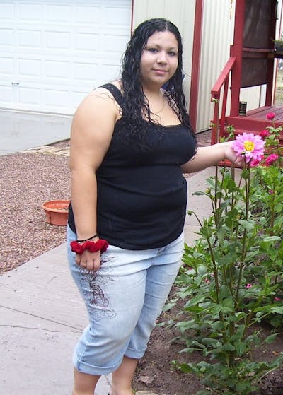 Weight Loss Before & After Gallery - Patient 119275924 - Image 1