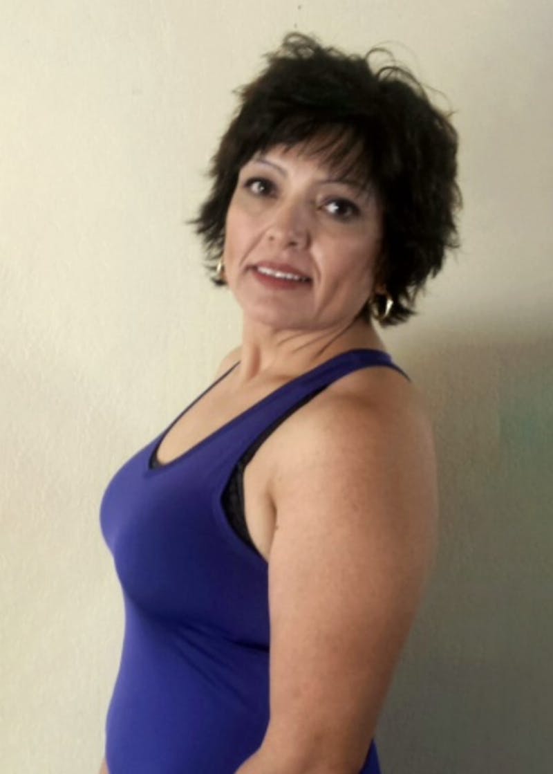 Weight Loss Before & After Gallery - Patient 119275939 - Image 2