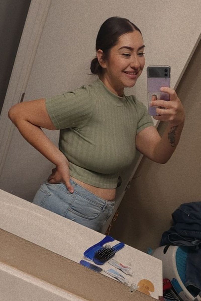 Weight Loss Before & After Gallery - Patient 246058 - Image 2