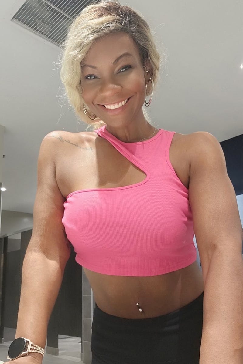 Weight Loss Before & After Gallery - Patient 245647 - Image 2