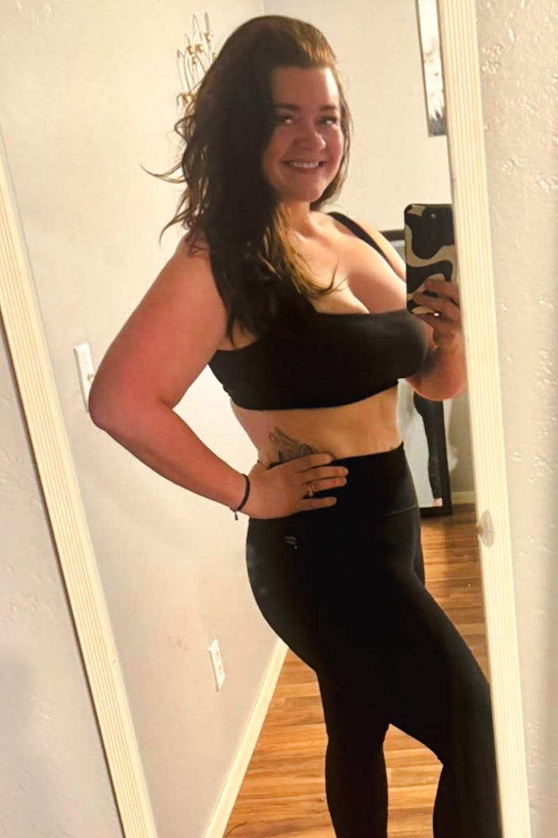 Weight Loss Before & After Gallery - Patient 559263 - Image 2
