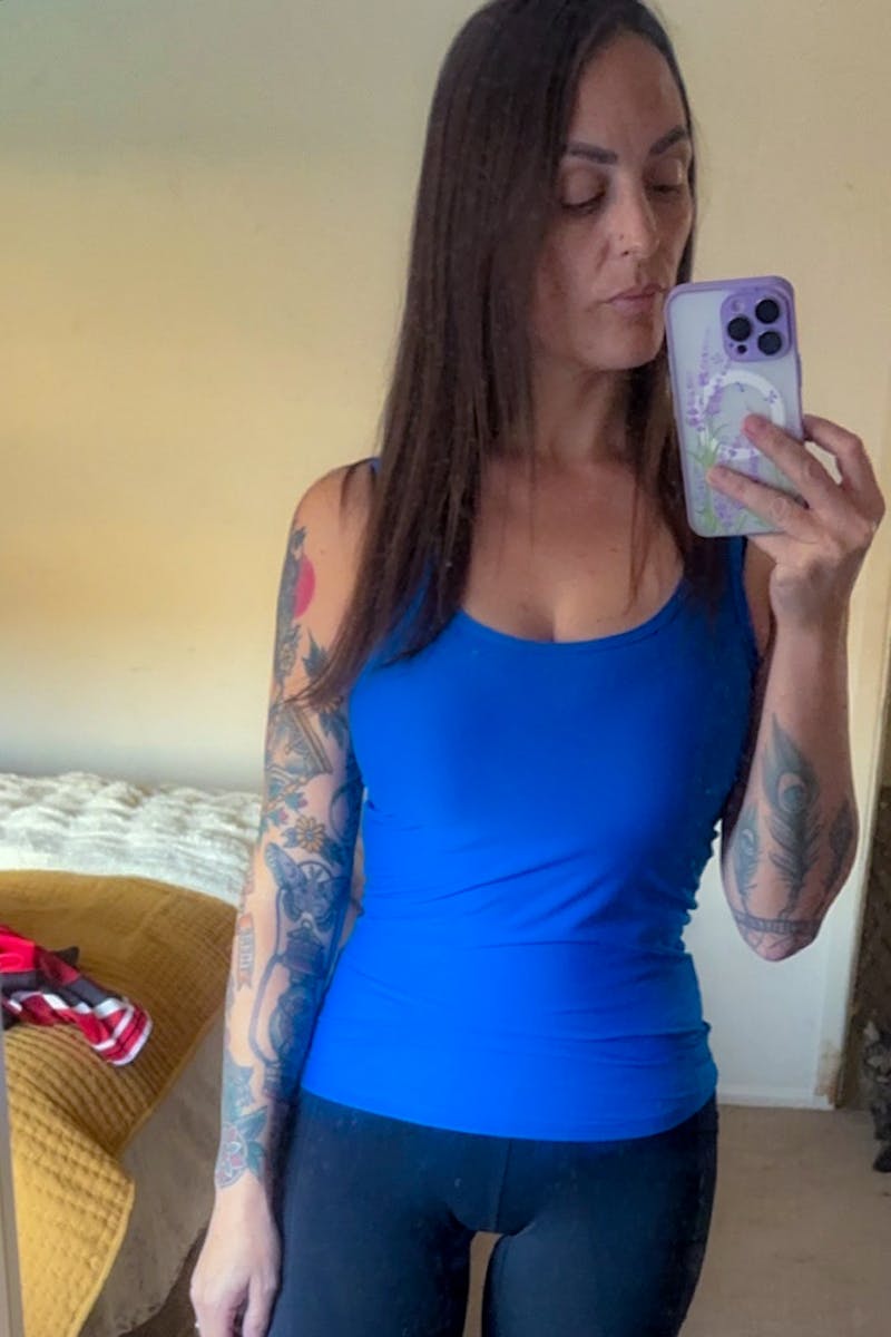 Weight Loss Before & After Gallery - Patient 332653 - Image 2