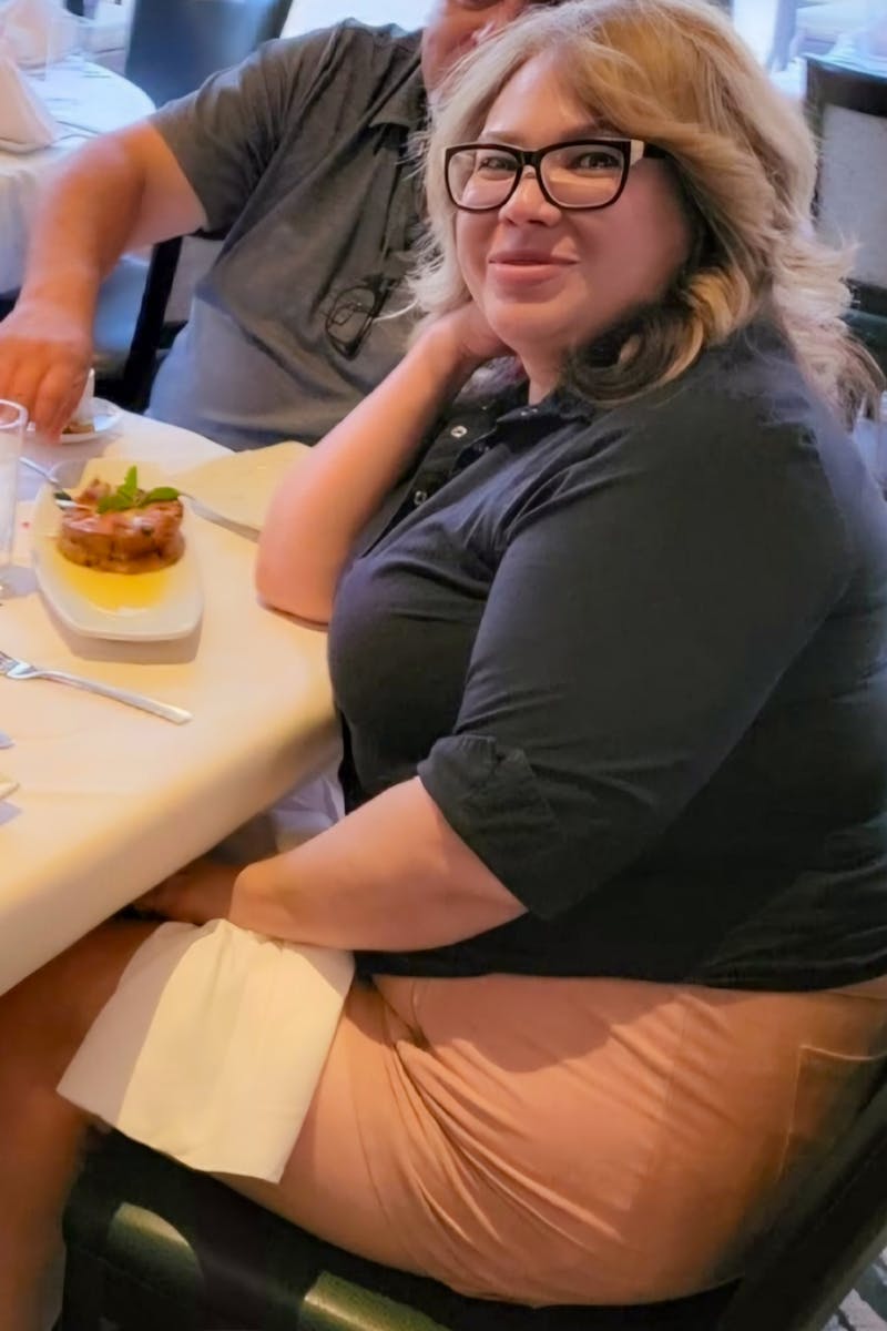 Weight Loss Before & After Gallery - Patient 366943 - Image 1