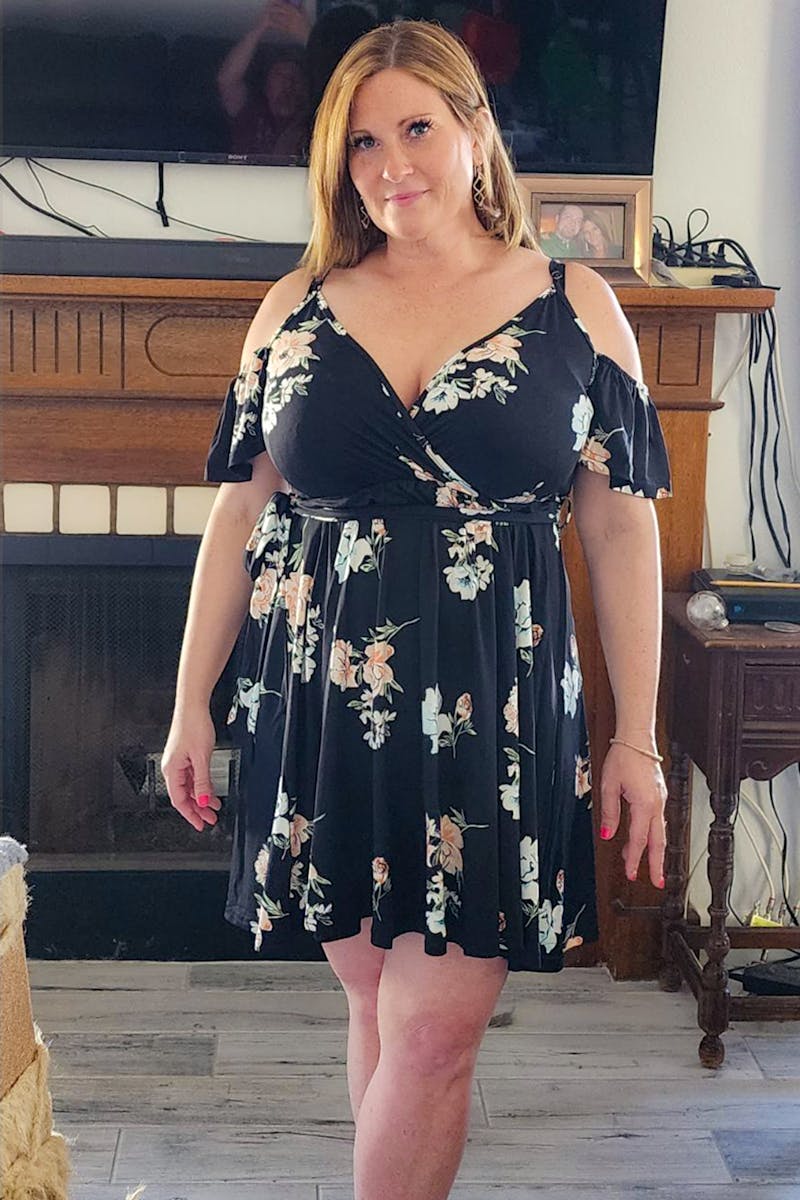 Weight Loss Before & After Gallery - Patient 397481 - Image 1