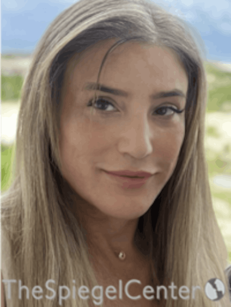 FFS Before & After Gallery - Patient 166645173 - Image 2
