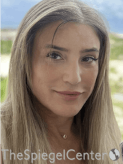 FFS Before & After Gallery - Patient 166645173 - Image 2