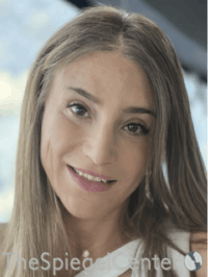 FFS Before & After Gallery - Patient 166645173 - Image 3