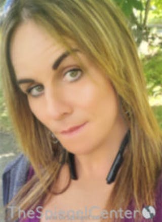 FFS Before & After Gallery - Patient 157140102 - Image 2