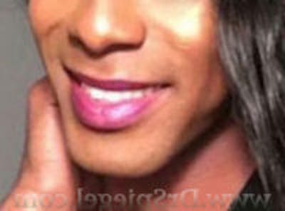 Mandible Contouring Before & After Gallery - Patient 157140160 - Image 1