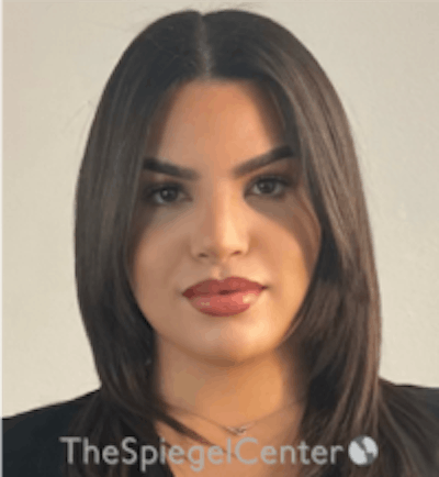 FFS Before & After Gallery - Patient 157140346 - Image 2