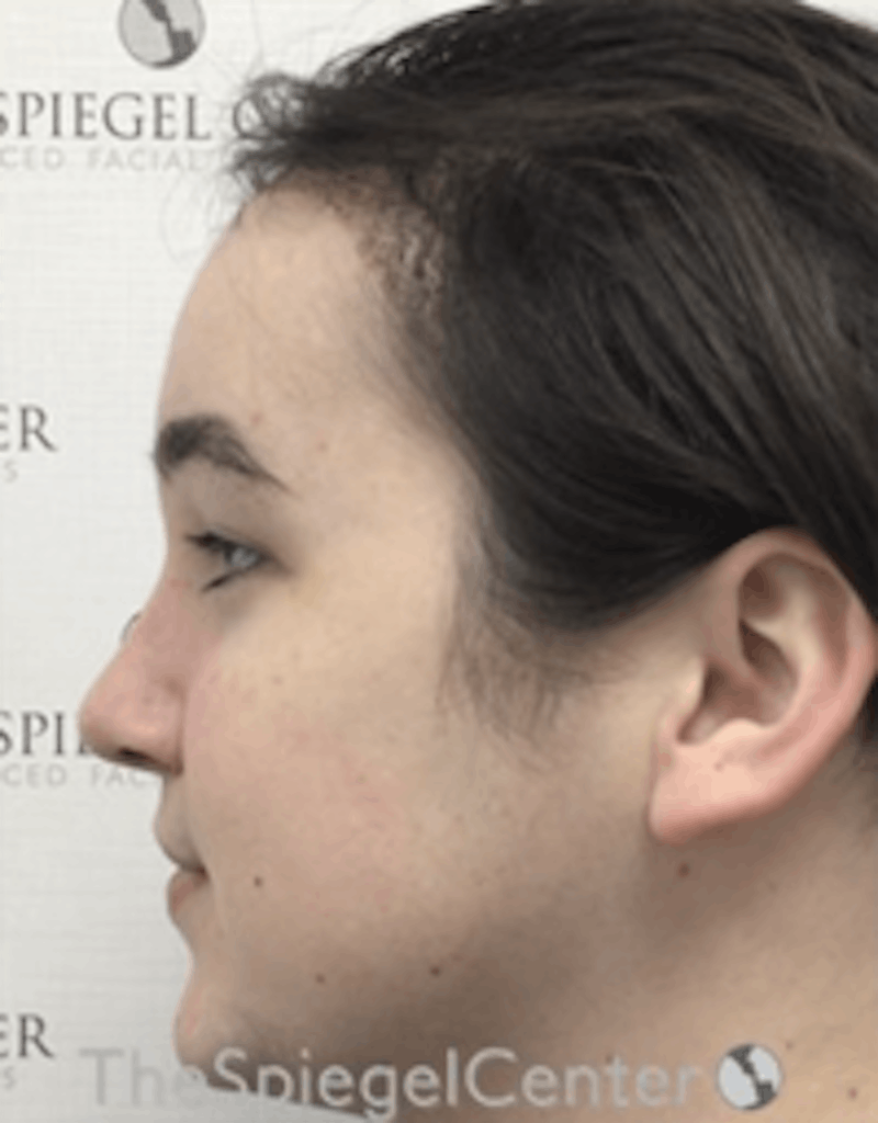 Hair Restoration Before & After Gallery - Patient 157140583 - Image 2