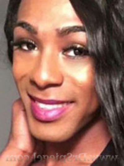 FFS Before & After Gallery - Patient 157140659 - Image 1