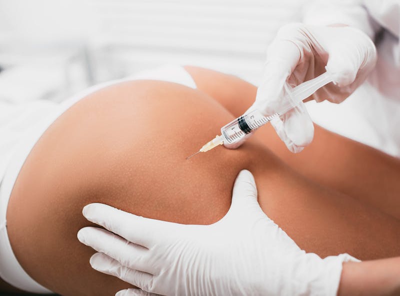 Non-surgical Butt Injection