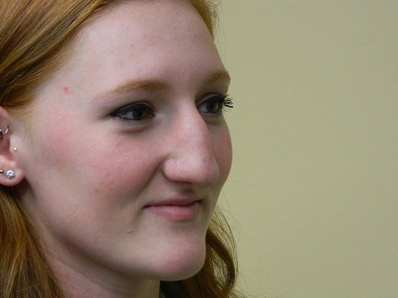 Rhinoplasty Before & After Gallery - Patient 133066210 - Image 5