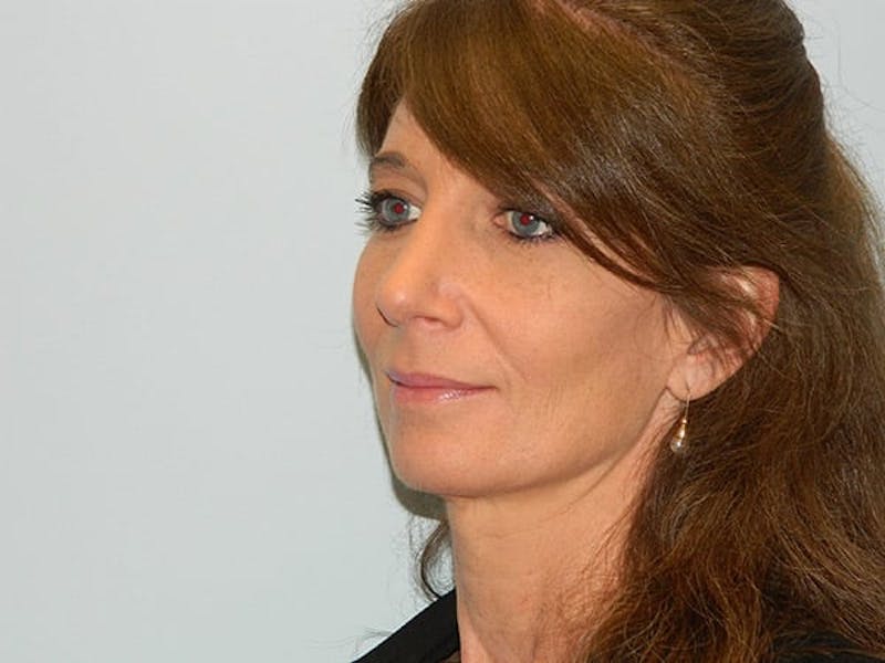 Rhinoplasty Before & After Gallery - Patient 133066224 - Image 6