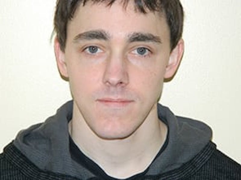Chin Reduction Before & After Gallery - Patient 133066254 - Image 1