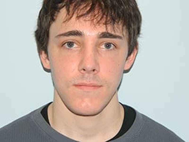 Chin Reduction Before & After Gallery - Patient 133066254 - Image 2