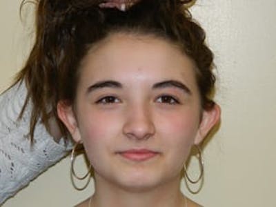 Otoplasty Before & After Gallery - Patient 133066441 - Image 1