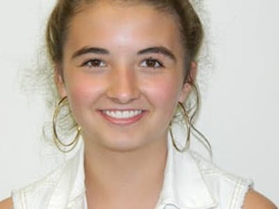 Otoplasty Before & After Gallery - Patient 133066441 - Image 2