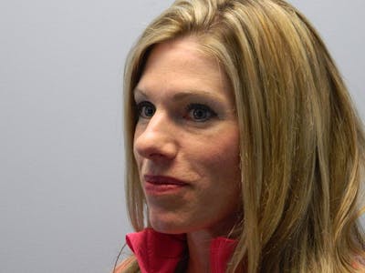 Rhinoplasty Before & After Gallery - Patient 133066463 - Image 1