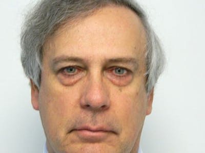 Blepharoplasty (Eyelid Lift) Before & After Gallery - Patient 133066469 - Image 1