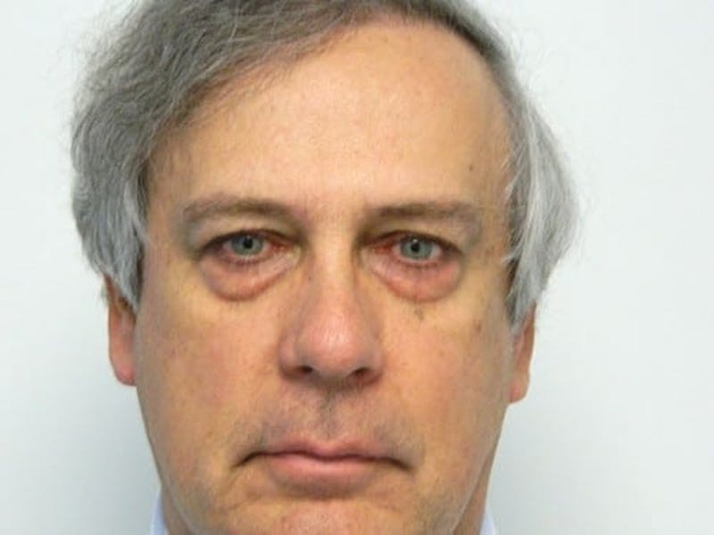 Blepharoplasty (Eyelid Lift) Before & After Gallery - Patient 133066469 - Image 1